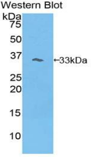Polyclonal Antibody to Phosphoinositide-3-Kinase Adaptor Protein 1 (PIK3AP1)