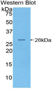 Polyclonal Antibody to Nucleotide Binding Oligomerization Domain Containing Protein 1 (NOD1)