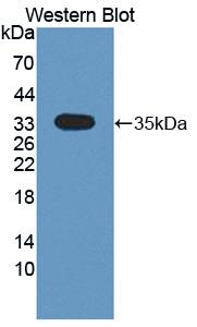 Polyclonal Antibody to CKLF Like MARVEL Transmembrane Domain Containing Protein 1 (CMTM1)
