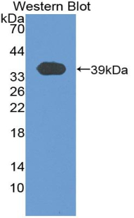 Polyclonal Antibody to T-Kininogen 1 (KNT1)