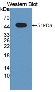 Polyclonal Antibody to Sprouty Related, EVH1 Domain Containing Protein 2 (SPRED2)