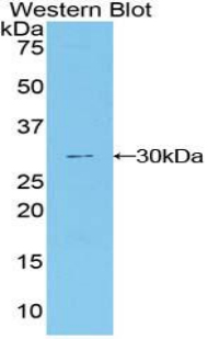 Polyclonal Antibody to Delta/Notch Like EGF Repeat Containing Protein (dNER)