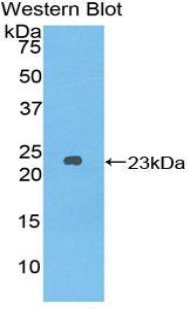 Polyclonal Antibody to Dishevelled, Dsh Homolog 2 (DVL2)