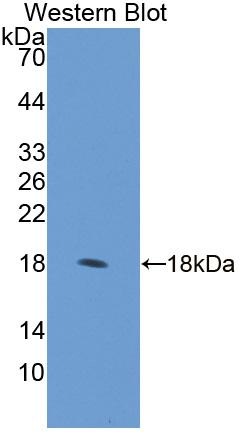 Polyclonal Antibody to RCC1 And BTB Domain Containing Protein 2 (RCBTB2)