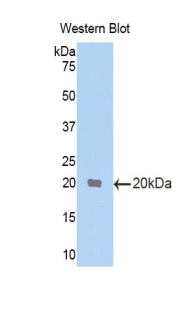 Polyclonal Antibody to Transformer 2 Beta (TRA2b)
