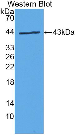 Polyclonal Antibody to Phospholipase A2, Group IVD (PLA2G4D)