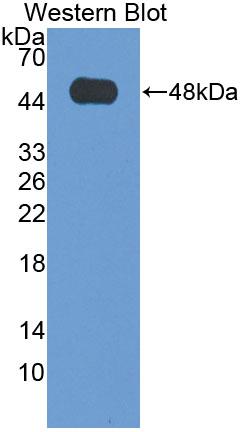 Polyclonal Antibody to Hepatocellular Carcinoma Related Protein 1 (HCRP1)