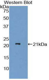 Polyclonal Antibody to A Disintegrin And Metalloproteinase With Thrombospondin 12 (ADAMTS12)