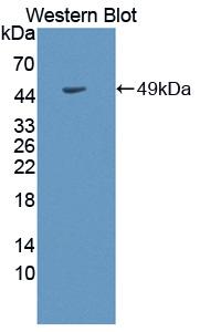 Polyclonal Antibody to PR Domain Containing Protein 14 (PRDM14)
