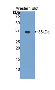 Polyclonal Antibody to Zeta Chain Associated Protein Kinase 70kDa (zAP70)