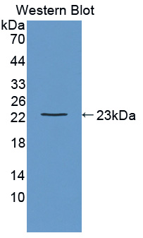 Polyclonal Antibody to Linker For Activation Of T-Cells Family, Member 2 (LAT2)