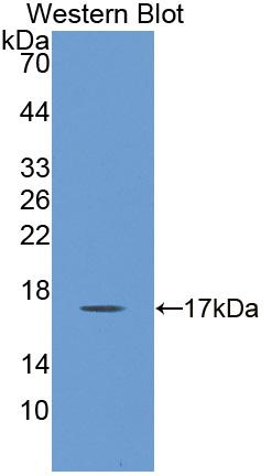 Polyclonal Antibody to SH3 Domain Binding Glutamic Acid Rich Protein Like Protein (SH3BGRL)