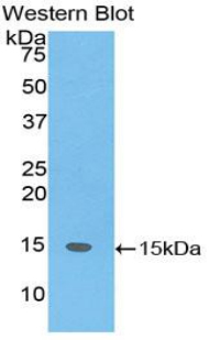 Polyclonal Antibody to SH2 Domain Containing Protein 1A (SH2D1A)