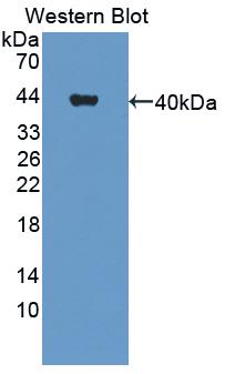 Polyclonal Antibody to Cell Adhesion Molecule With Homology To L1CAM (CHL1)