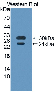 Polyclonal Antibody to BMX Non Receptor Tyrosine Kinase (BMX)