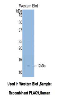 Polyclonal Antibody to Placenta Specific Protein 9 (PLAC9)