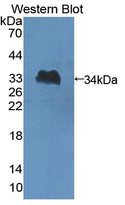 Polyclonal Antibody to Schlafen Family Member 5 (SLFN5)