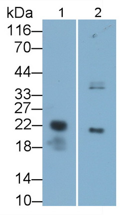 Polyclonal Antibody to Zymogen Granule Protein 16 Homolog B (ZG16B)