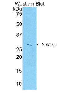 Polyclonal Antibody to A Disintegrin And Metalloprotease 5 (ADAM5)