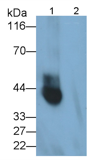 Recombinant Antibody to Programmed Cell Death Protein 1 Ligand 1 (PDL1)