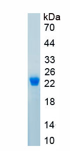 Recombinant Erythropoietin (EPO)