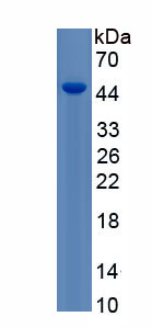 Recombinant Interleukin 2 (IL2)