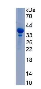Recombinant Stem Cell Factor (SCF)