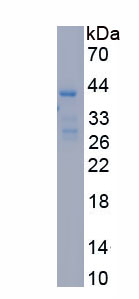 Recombinant Stromal Cell Derived Factor 1 (SDF1)