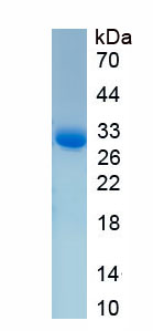 Recombinant Collagen Type IV Alpha 1 (COL4a1)