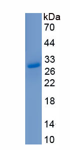 Recombinant Collagen Type IV Alpha 1 (COL4a1)