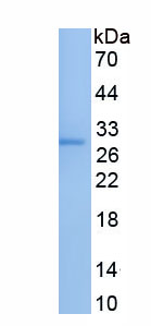 Recombinant Triggering Receptor Expressed On Myeloid Cells 1 (TREM1)