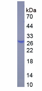 Recombinant Glutathione Peroxidase 1 (GPX1)