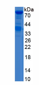 Recombinant X-Ray Repair Cross Complementing 6 (XRCC6)