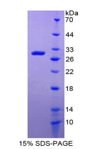 Recombinant Damage Specific DNA Binding Protein 2 (DDB2)