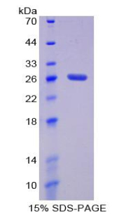 Recombinant Damage Specific DNA Binding Protein 2 (DDB2)