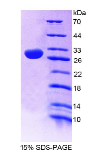 Recombinant Nitric Oxide Synthase 1 Adaptor Protein (NOS1AP)