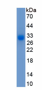Recombinant Collagen Type I Alpha 1 (COL1a1)
