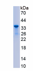 Recombinant Complement Component 5a (C5a)