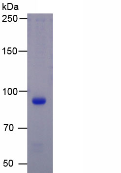 Recombinant Creatine Kinase MB Isoenzyme (CKMB)