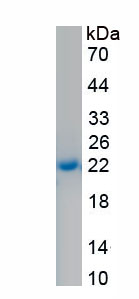 Recombinant N-Terminal Pro-Atrial Natriuretic Peptide (NT-ProANP)