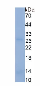 Recombinant Aquaporin 9 (AQP9)