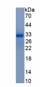 Recombinant Aldolase A, Fructose Bisphosphate (ALDOA)