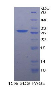 Recombinant Casein Kinase 1 Alpha 1 (CSNK1a1)