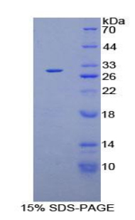 Recombinant Casein Kinase 1 Alpha 1 (CSNK1a1)