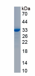 Recombinant Carbonic Anhydrase II (CA2)