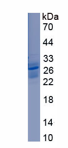 Recombinant Neuromedin B (NMB)
