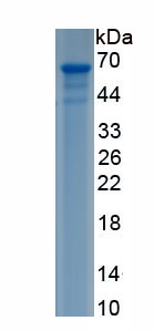 Recombinant Death receptor 5 (DR5)