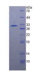 Recombinant Heat Shock 70kDa Protein 4 (HSPA4)