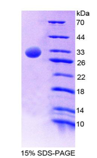 Recombinant General Transcription Factor IIH Subunit 1 (GTF2H1)