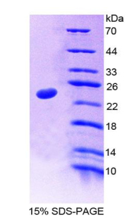 Recombinant Nucleoporin 35kDa (NUP35)